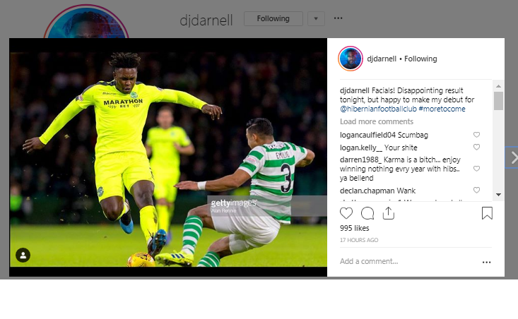 Hibs star posts picture of horror challenge on Izaguirre on social media!